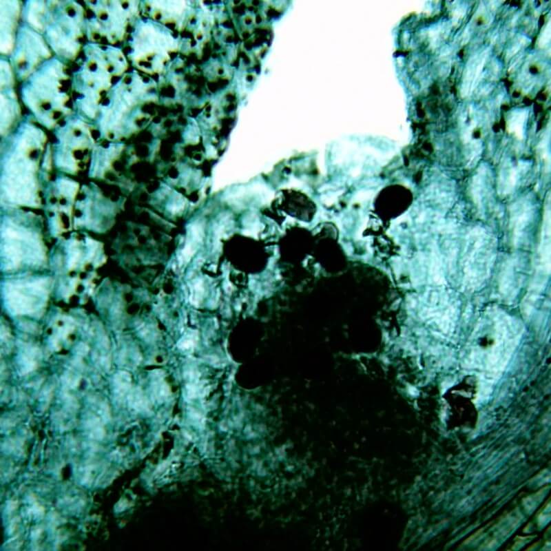 Microscop digital Bresser LCD-35 (0,3-5MP) pentru profesor