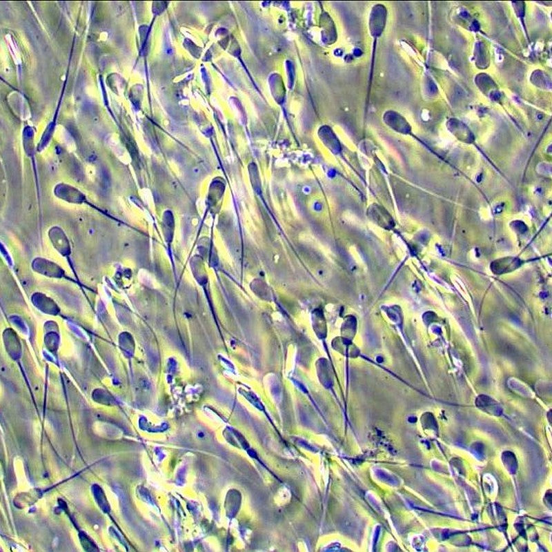 Microscop biologic BIM-313T PLAN LED (40x-1000x) (resigilat) image 4