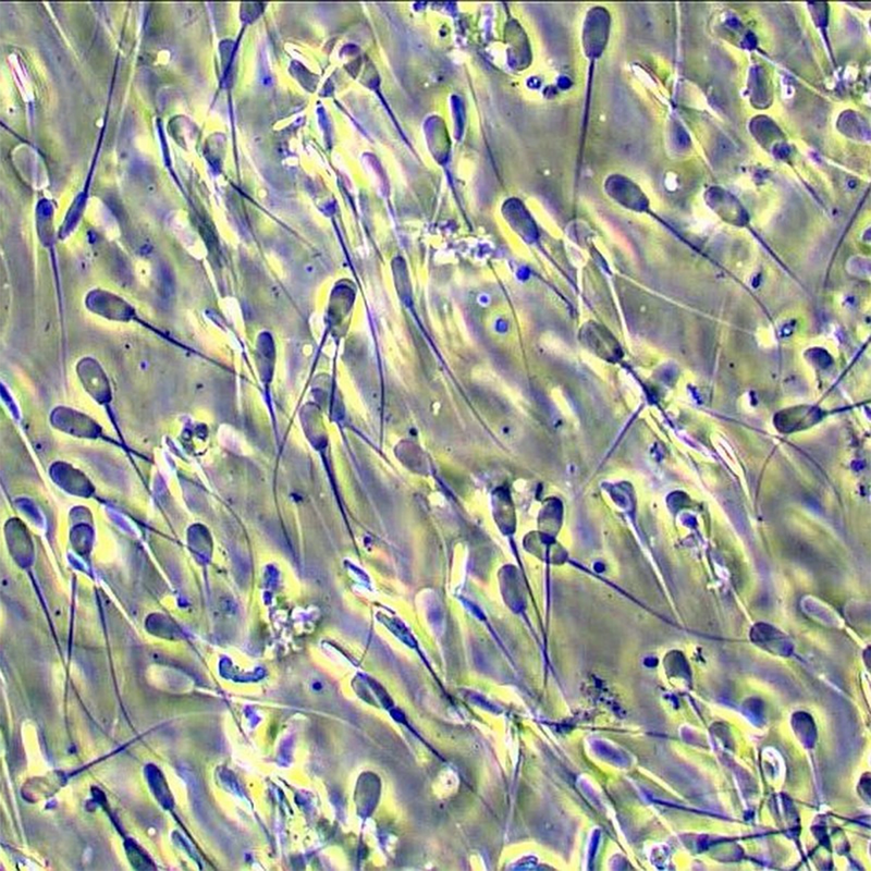 Microscop biologic trinocular BIM-313T PLAN LED (40x-1000x)