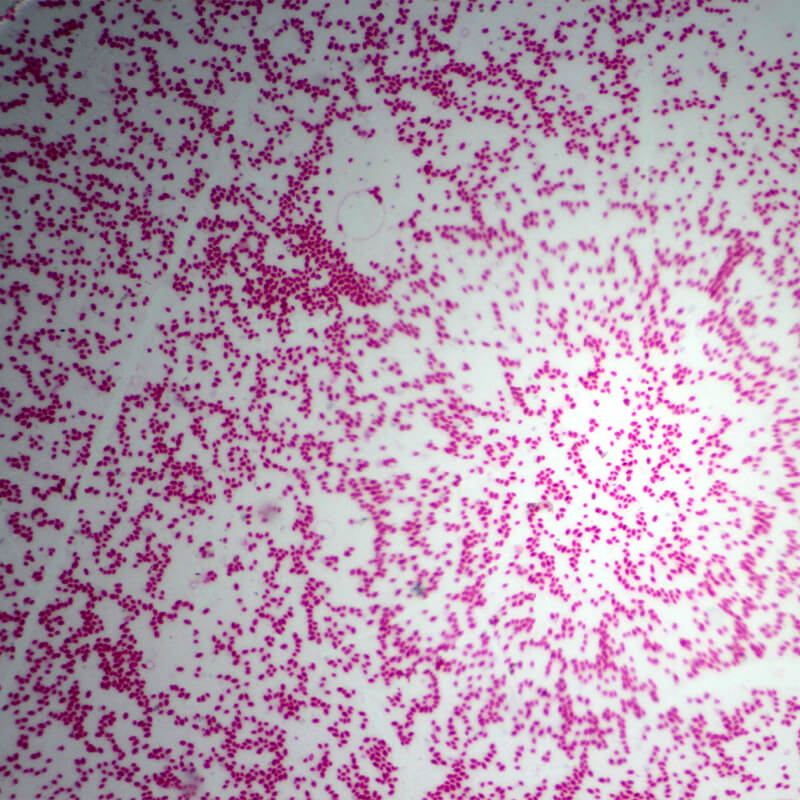 Set preparate mixt pentru microscop (25 buc)