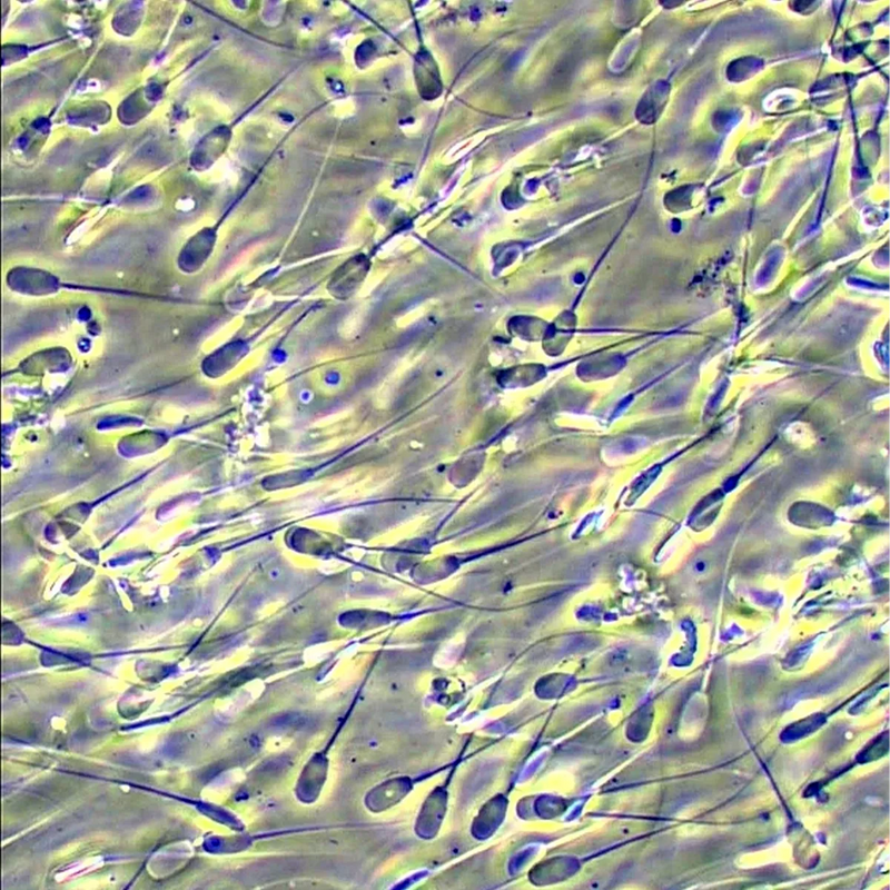 Microscop biologic trinocular BIM-151T LED (40-1000x)