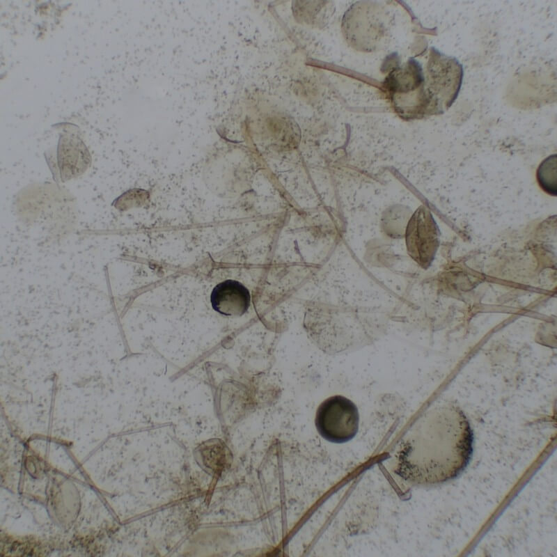 Camera digitale MicroQ-SP pentru microscop