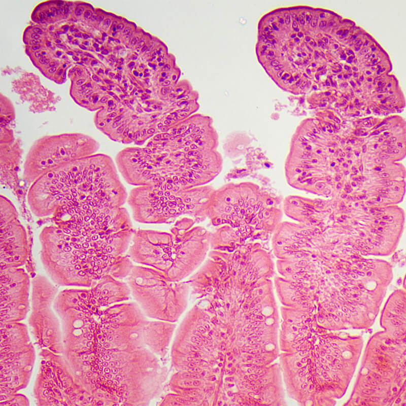 Microscop biologic Lacerta Travel (40x - 1000x)