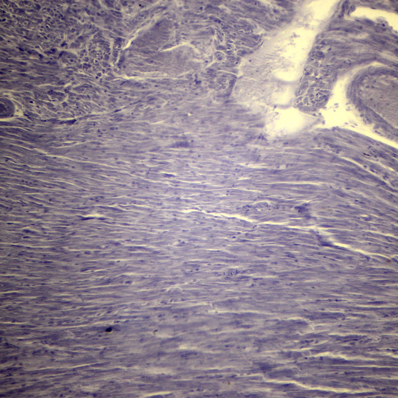 Microscop biologic trinocular BIM-151T LED (40-1000x)