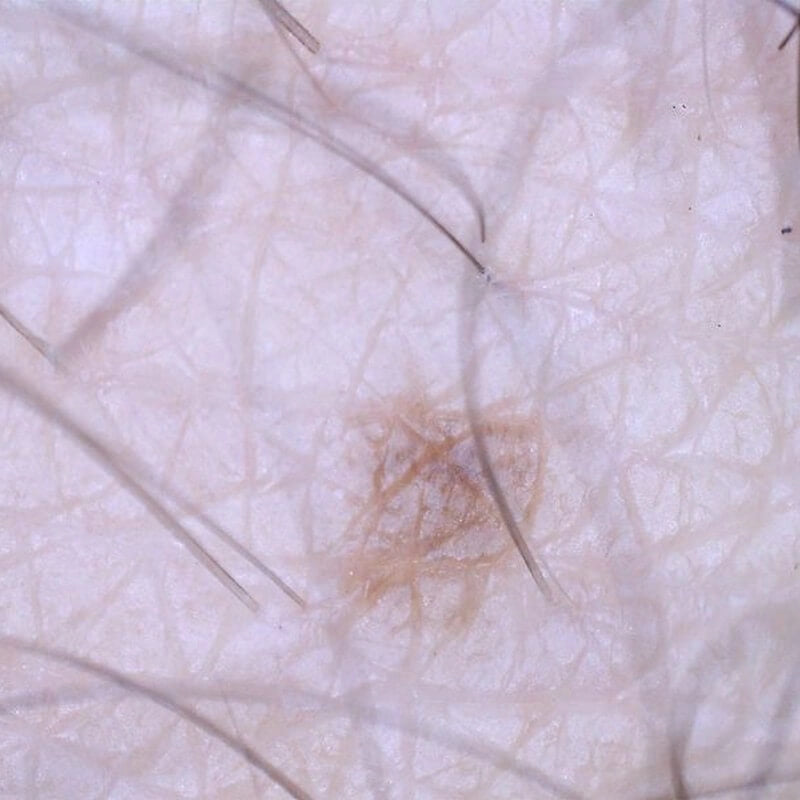 Microscop digital portabil DELTA Smart PRO 5MP