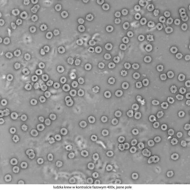 Microscop biologic trinocular DELTA Genetic Pro Trino (40x-1000x)