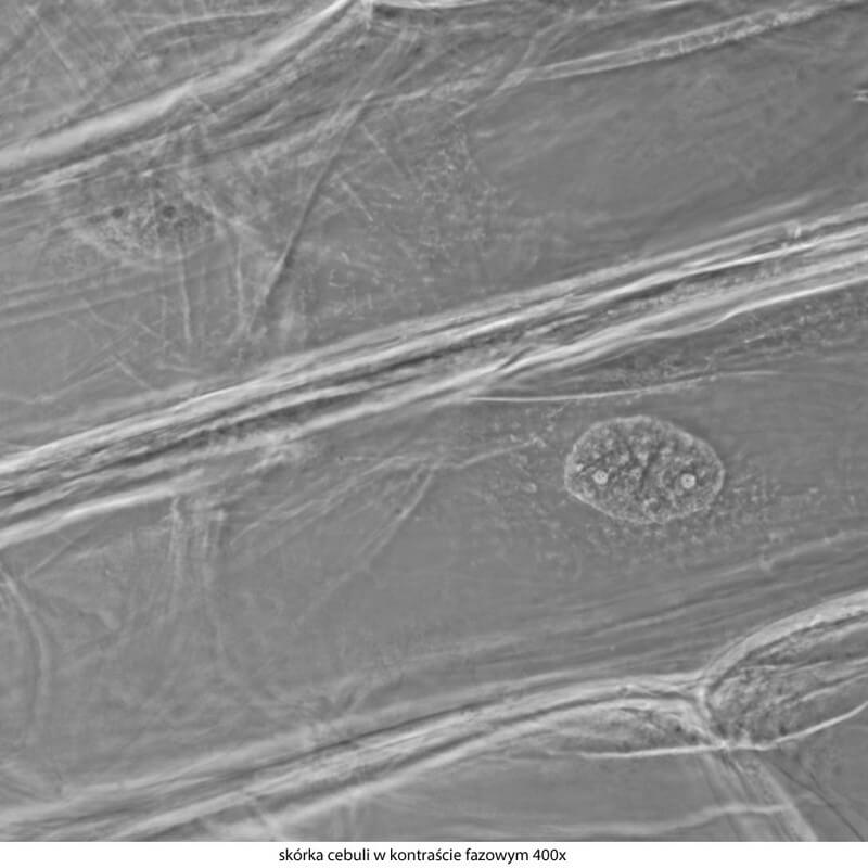 Microscop biologic trinocular DELTA Genetic Pro Trino (40x-1000x)