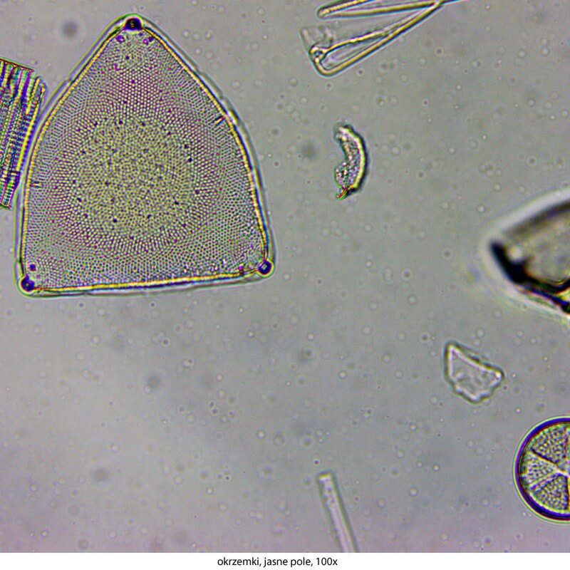 Microscop biologic binocular DELTA Genetic Pro Bino (40x-1000x)