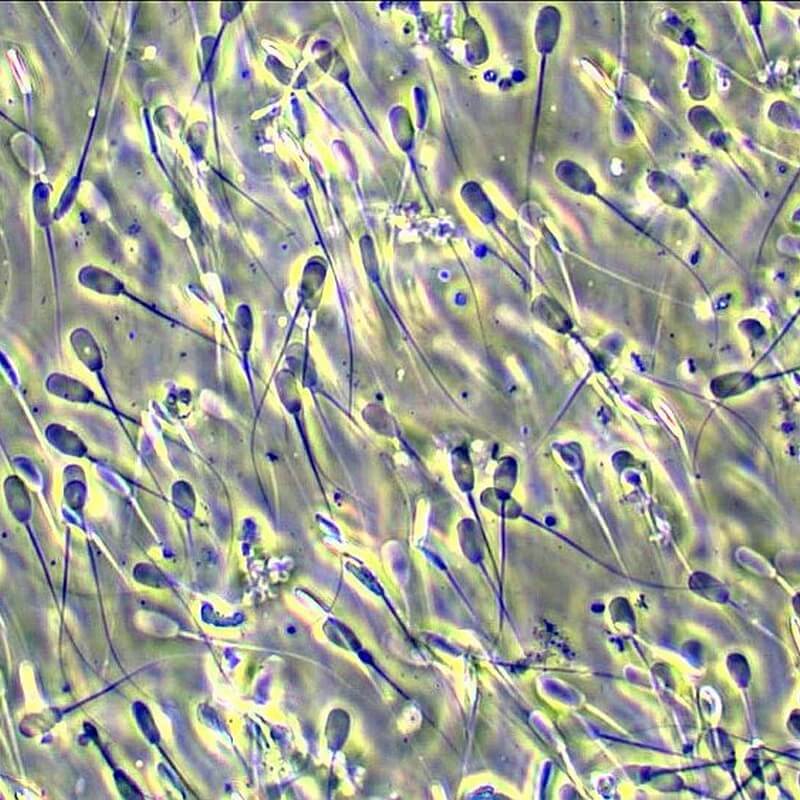 Microscop biologic trinocular BIM-312T semi-PLAN (40x - 1000x) image 4